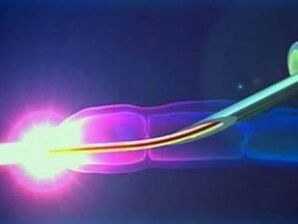 Laser la serviciu