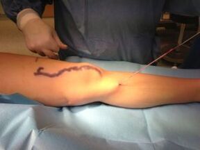 chirurgie